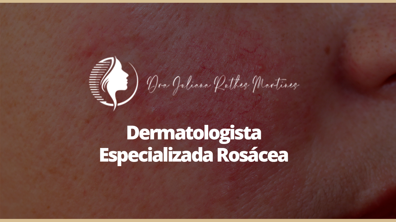 Dermatologista Especializada Rosácea Dra. Juliana